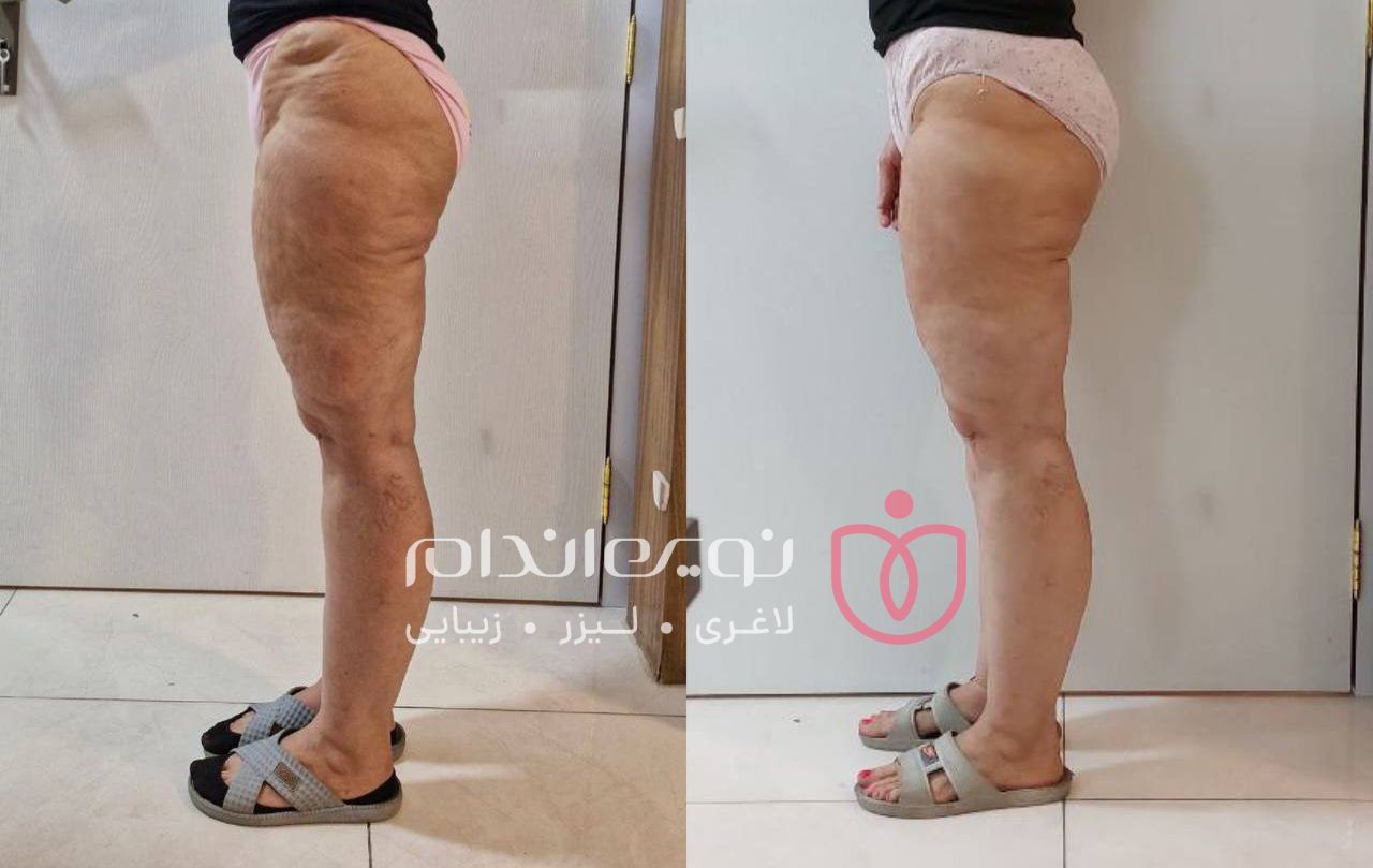 مجموعه زیبایی و لاغری نوین